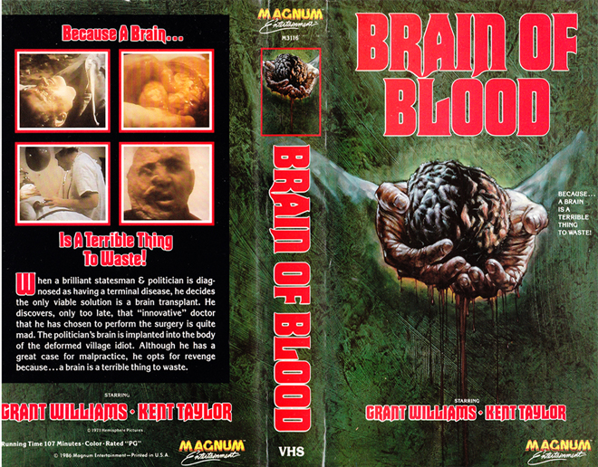 BRAIN OF BLOOD